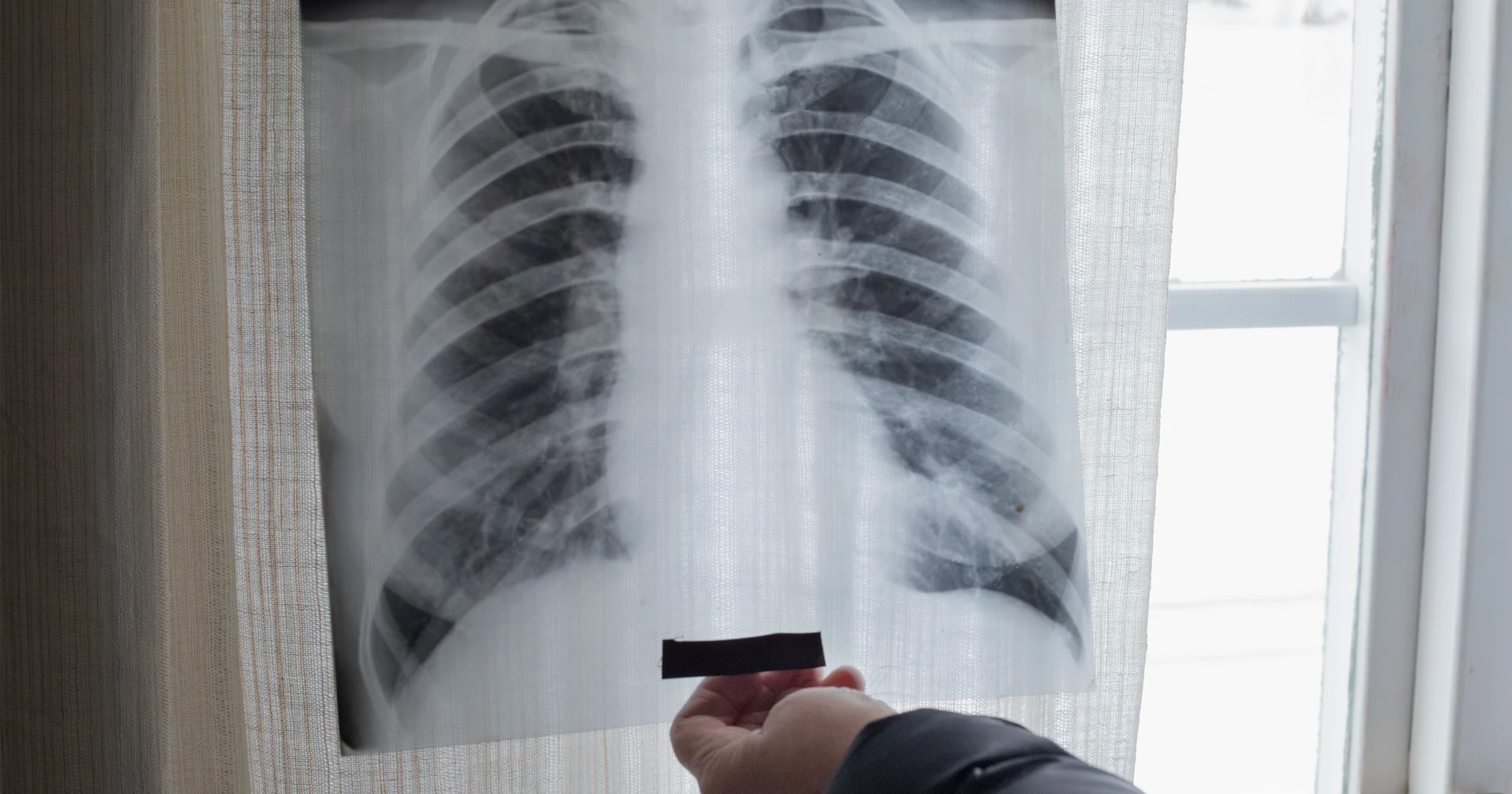 Ett fotografi på en röntgenbild.